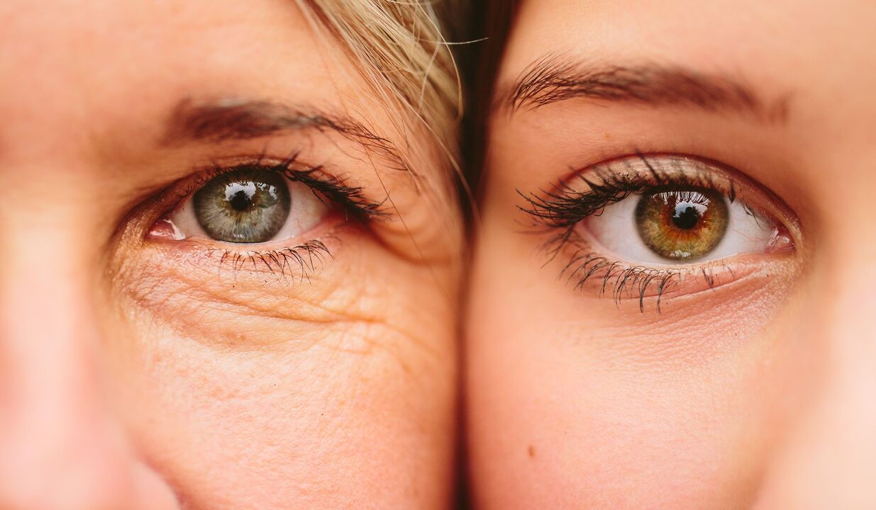 oznaki starzenia wokół oczu